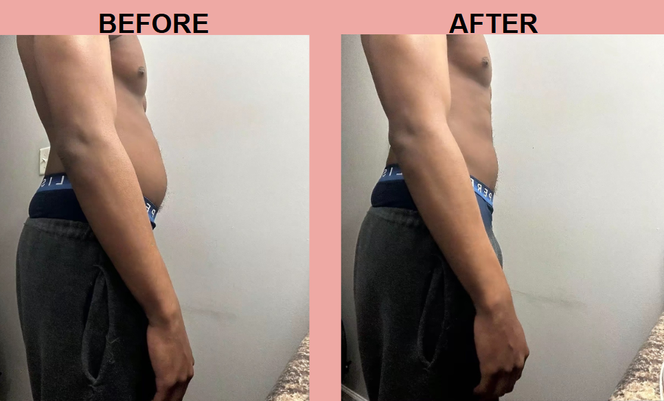 Apple Cider Vinegar Gummies